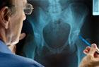 Indiana's Leadership in Medical Devices